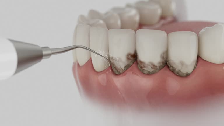 Trusted Wisdom Tooth Removal service in Wartburg, TN - Dentist Open Now
